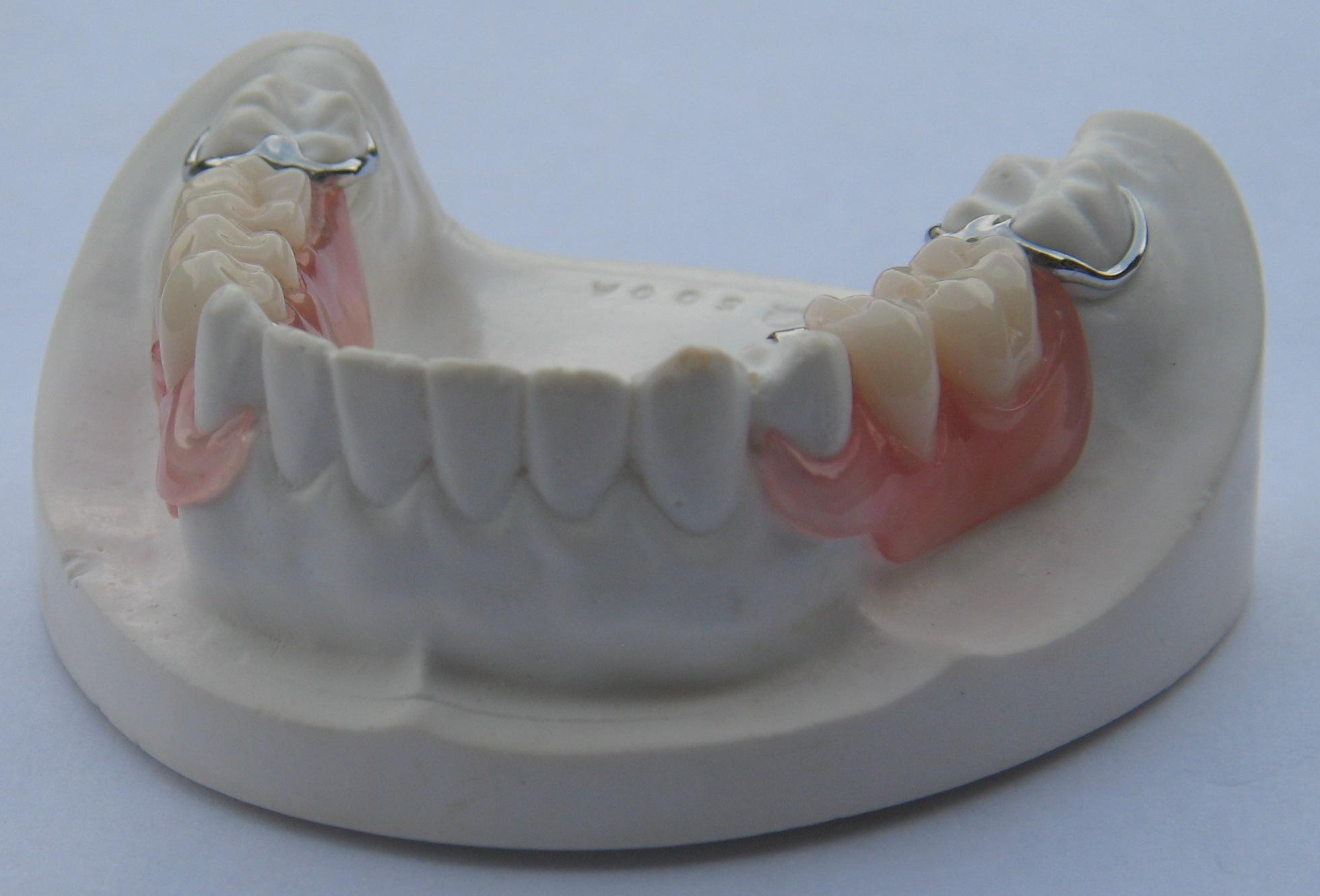 verliezen deadline Clancy Flexibele protheses - DentallXS