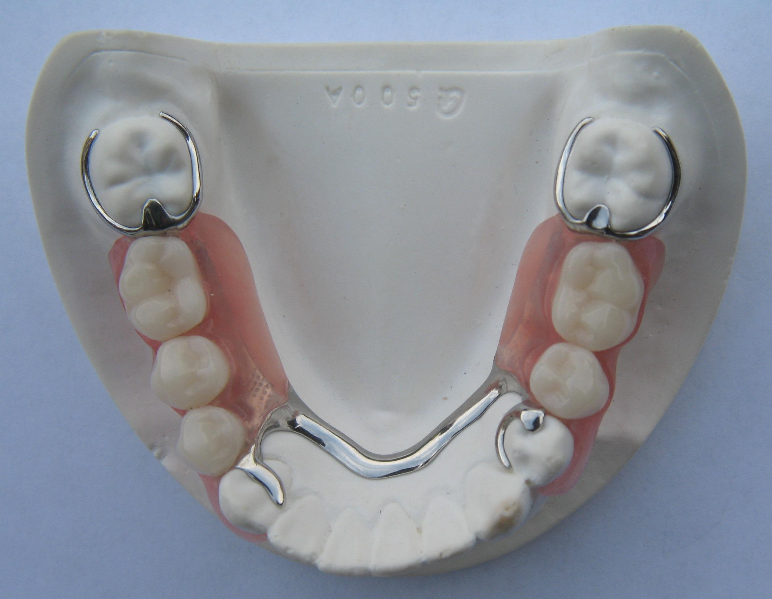 verliezen deadline Clancy Flexibele protheses - DentallXS