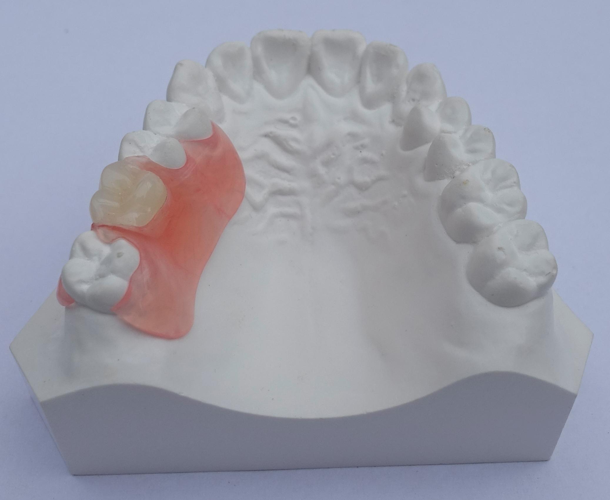 verliezen deadline Clancy Flexibele protheses - DentallXS