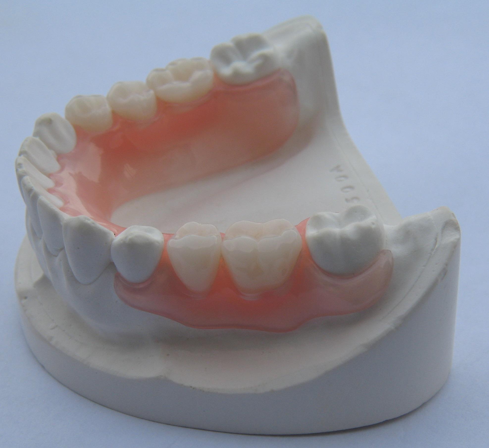 verliezen deadline Clancy Flexibele protheses - DentallXS