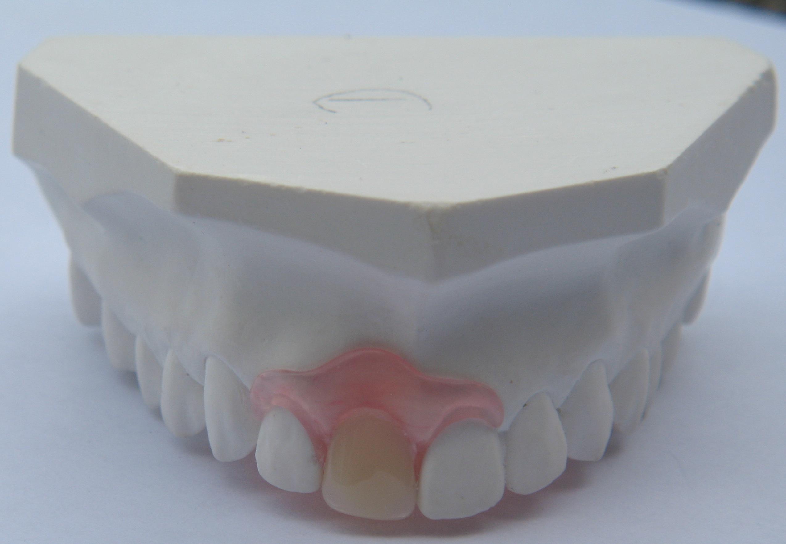 Demon Play Mus behandeling Flexibele protheses - DentallXS