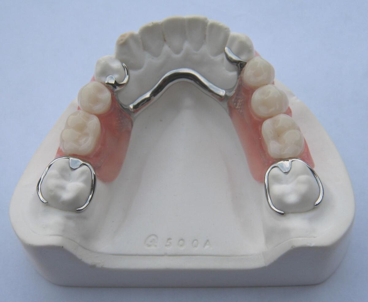 frameprothese2_2.jpg